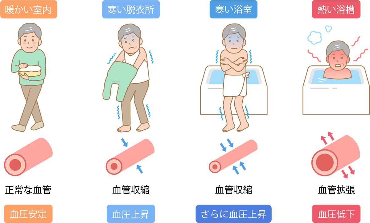 温度差ストレスと血圧の変動
